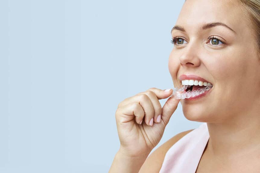 3 Reasons to Consider Invisalign or Clear Aligners according to Chomp Dental