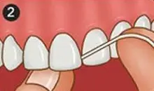 Floss Step 2