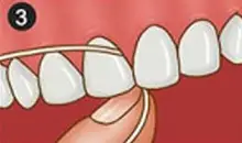 Floss Step 3