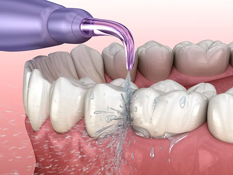 Waterpik