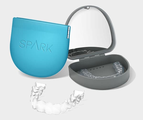 A Spark Aligners sample at Chomp Dental