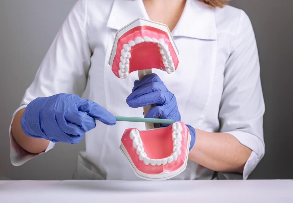 Staff at Chomp Dental using a model to display a wisdom teeth